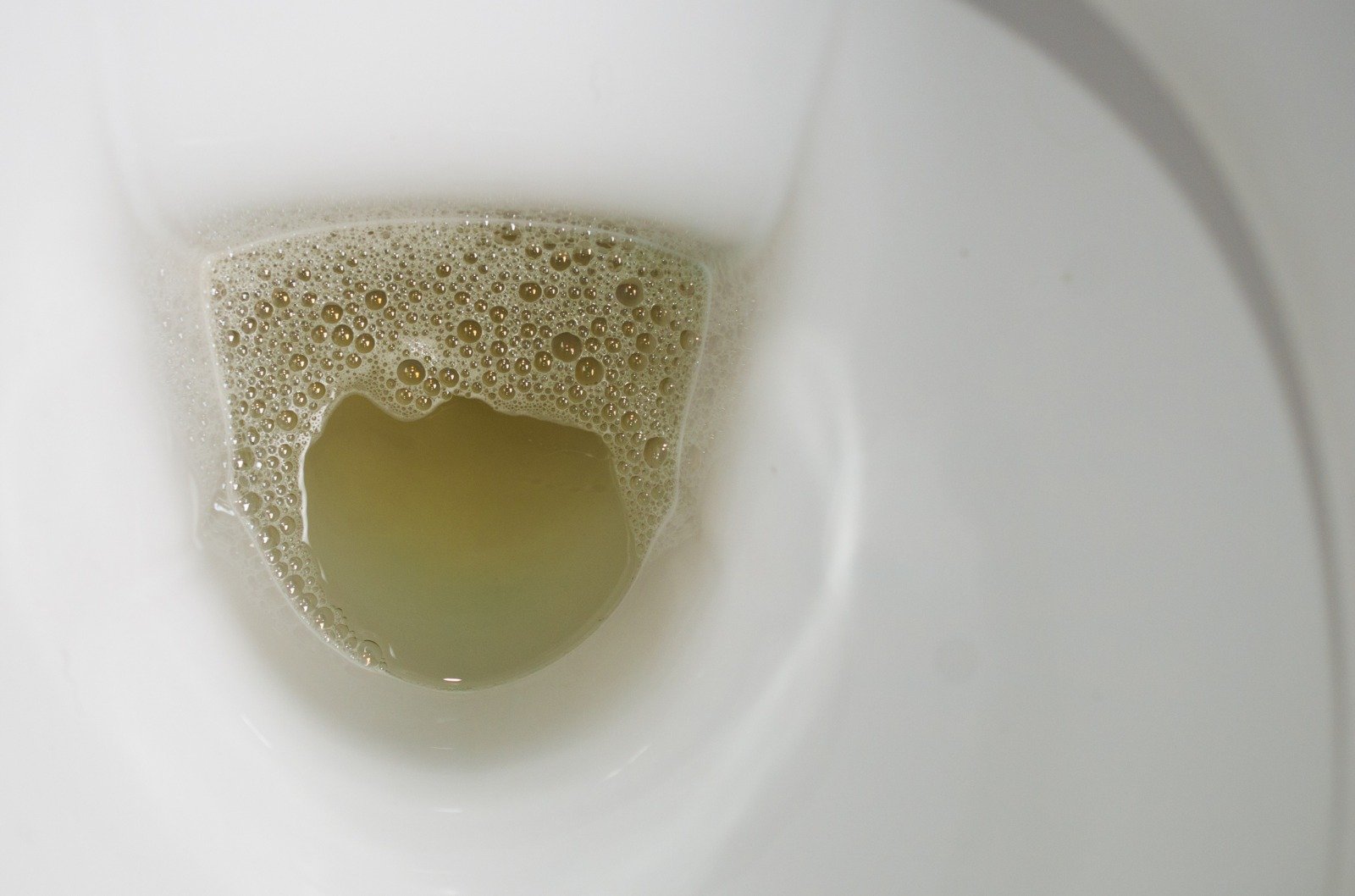 Foam in urine